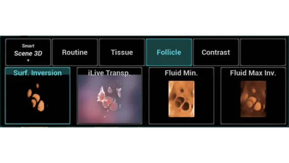 Клинические изображения УЗИ аппарат Mindray Imagyn I9