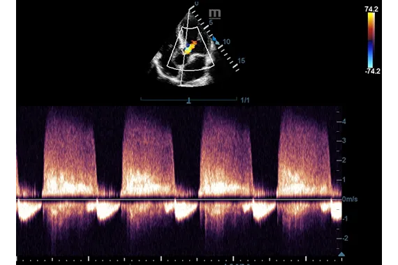 Клинические изображения УЗИ аппарат Mindray DC-45