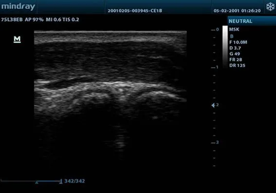 Клинические изображения УЗИ аппарат Mindray DP-10 Vet ветеринарный портативный