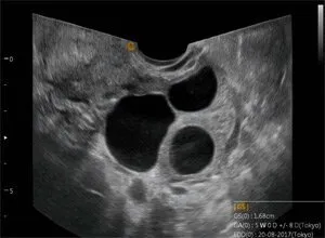 Клинические изображения УЗИ аппарат Chison i8