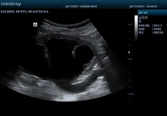 Клинические изображения УЗИ аппарат Mindray DP-50 портативный