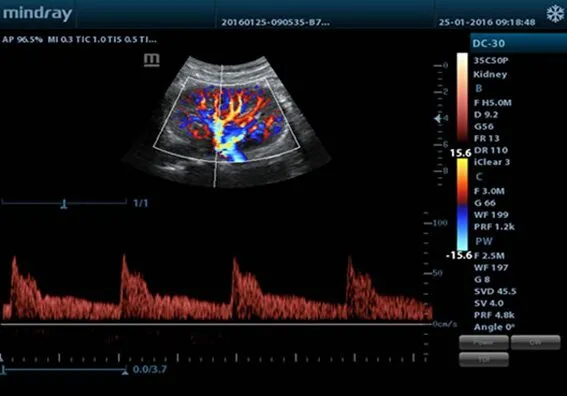 Клинические изображения Mindray M5
