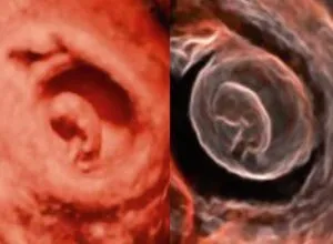 Клинические изображения УЗИ аппарат Chison i8