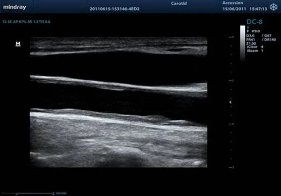 Клинические изображения УЗИ аппарат Mindray DC-8
