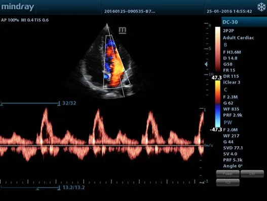 Клинические изображения Mindray M5