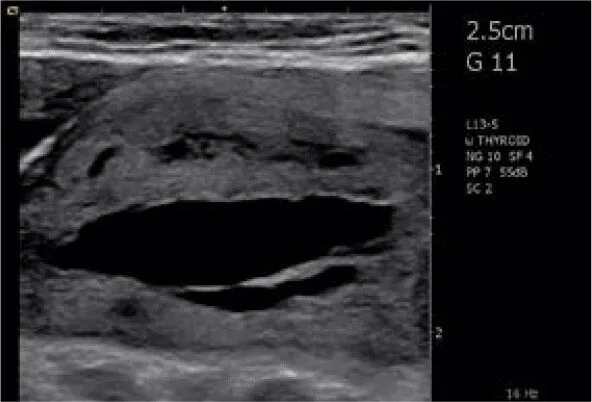 Клинические изображения Siemens Acuson Freestyle УЗИ аппарат портативный