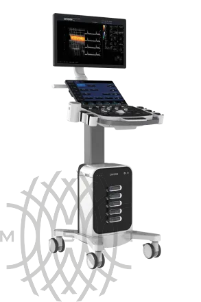 Chison i9 ультразвуковой аппарат