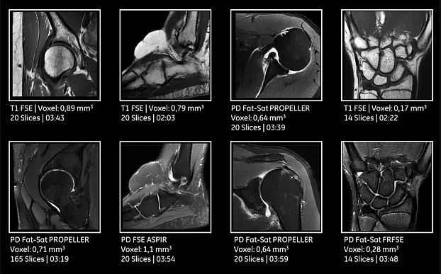 Клинические изображения МРТ аппарат GE SIGNA Pioneer 3T