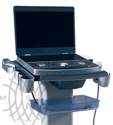 УЗИ аппарат Mindray MX7 портативный