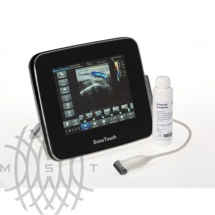 Chison SonoTouch 30 портативный УЗИ аппарат