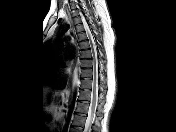 Клинические изображения Магнитно-резонансный томограф GE HealthCare Optima MR450w