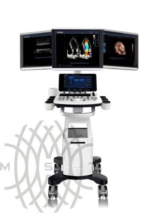 Chison Qbit 6 ультразвуковой аппарат