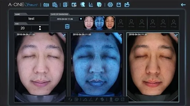 Клинические изображения Аппарат для 3D-визуализации и диагностики кожи Bomtech A-ONE Smart