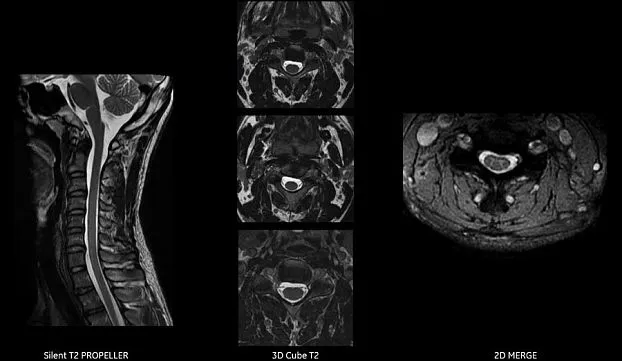 Клинические изображения МРТ аппарат GE SIGNA Voyager 1.5T