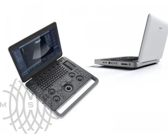 Sonoscape X3 ультразвуковой аппарат