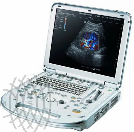УЗИ аппарат Mindray M7 портативный