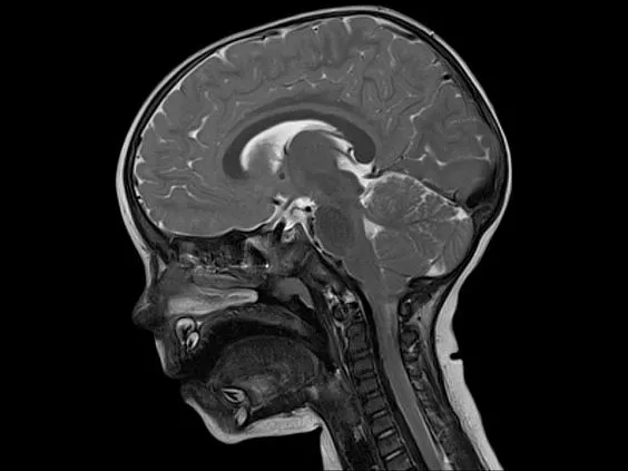 Клинические изображения Магнитно-резонансный томограф Siemens MAGNETOM Skyra 3T