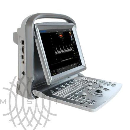 УЗИ аппарат Chison ECO 5
