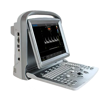 УЗИ аппарат Chison ECO 5