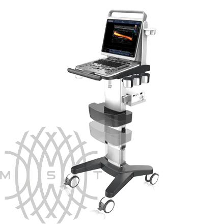 Chison EBit 30 ультразвуковой аппарат