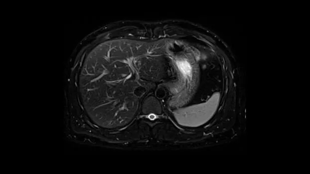Клинические изображения МРТ аппарат SIEMENS Magnetom Amira 1.5T