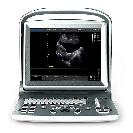 Chison SonoTouch 20 УЗИ аппарат портативный
