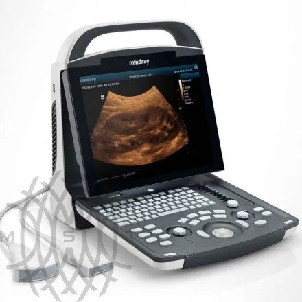 УЗИ аппарат Mindray DP-10 Vet ветеринарный портативный