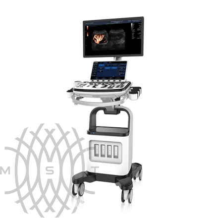 Chison XBit 90 ультразвуковой аппарат