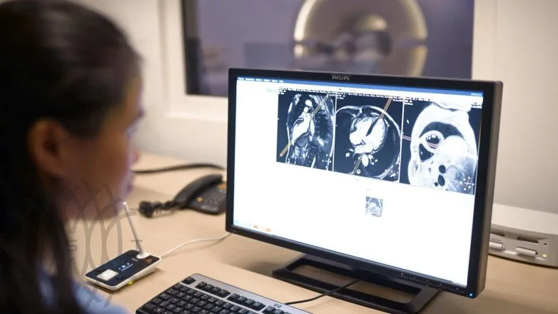 МРТ аппарат Philips Ingenia 3.0T
