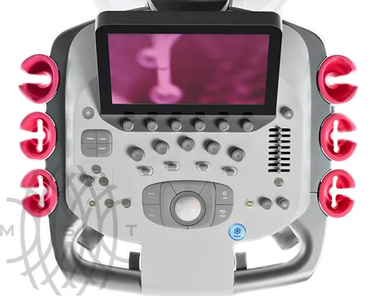 Siemens Acuson S1000 ультразвуковая система