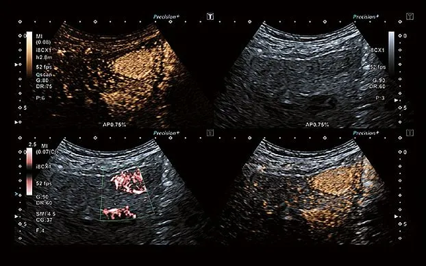 Клинические изображения Canon (Toshiba) Aplio i800 аппарат УЗИ