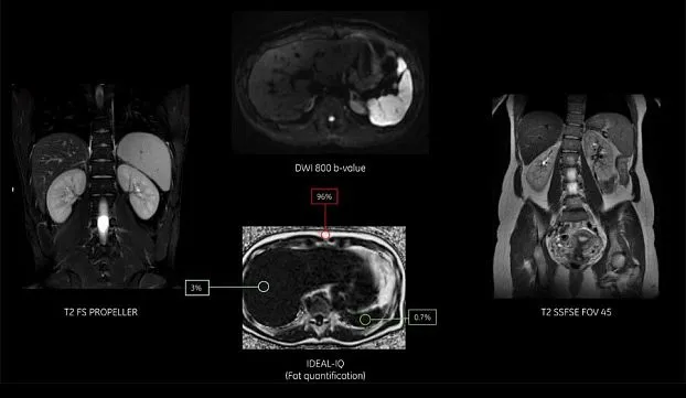 Клинические изображения УЗИ аппарат GE HealthCare Logiq F6