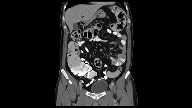 Клинические изображения Siemens SOMATOM go.Up компьютерный томограф