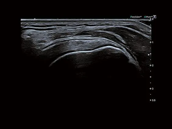 Клинические изображения Canon (Toshiba) Aplio a450 аппарат УЗИ