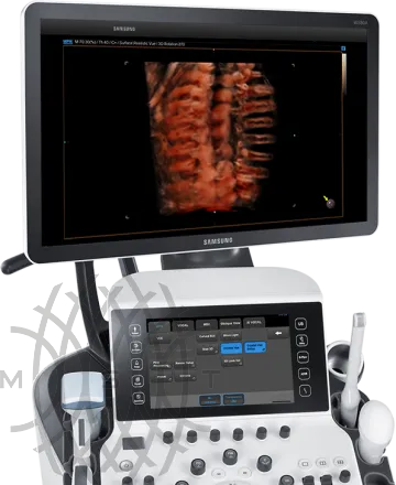 Samsung Medison WS80A УЗИ аппарат