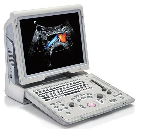 УЗИ аппарат Mindray Z6 портативный