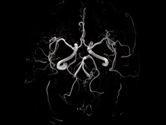 Клинические изображения Магнитно-резонансный томограф Siemens MAGNETOM Aera 1.5T