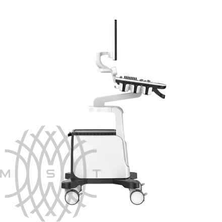 УЗИ аппарат Chison Qbit 5