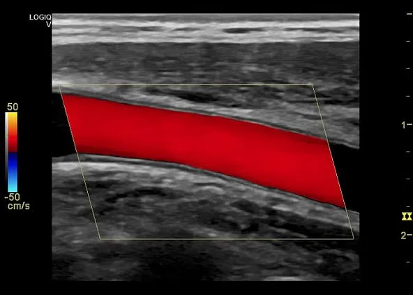 Клинические изображения УЗИ аппарат GE HealthCare Vscan Air карманный