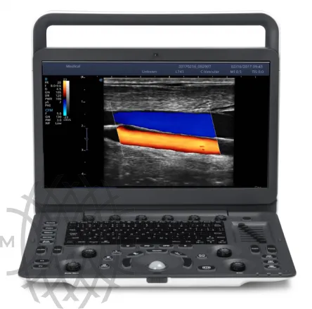 Sonoscape E2 ультразвуковой аппарат