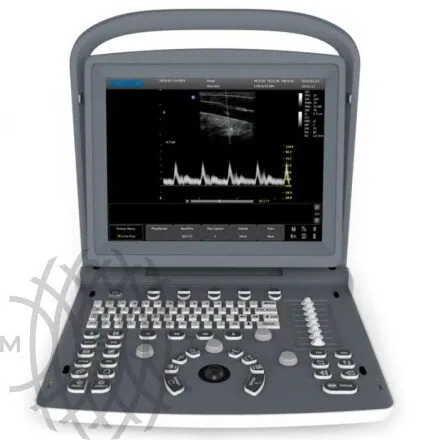 УЗИ аппарат Chison ECO 2