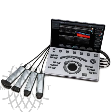 УЗИ аппарат Chison SonoTouch 50 (Sonoair) портативный