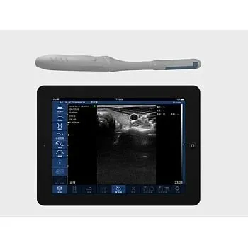 УЗИ аппарат ЕЛС-МЕД ЕЛС500 Мини