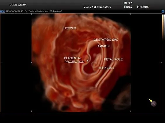 Клинические изображения Samsung Medison WS80A УЗИ аппарат