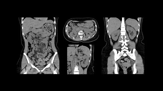 Клинические изображения GE HealthCare Revolution EVO компьютерный томограф
