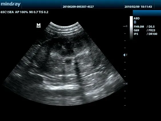 Клинические изображения УЗИ аппарат Mindray DP-50 Vet ветеринарный портативный