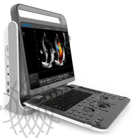 Портативный УЗИ аппарат Chison SonoTouch 60 Pro