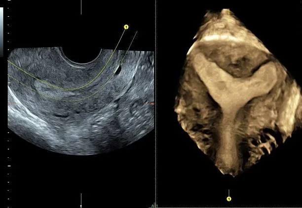 Клинические изображения УЗИ аппарат GE HealthCare Voluson S10