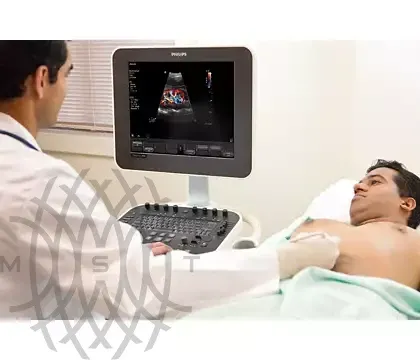 Philips ClearVue 350 ультразвуковой аппарат