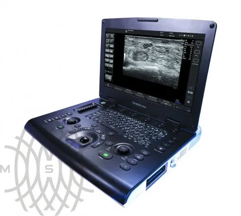 УЗИ аппарат GE Healthcare Versana Active портативный